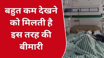 बच्ची के पेट से निकले ढाई किलो बाल के गुच्छे, डॉक्‍टर भी रह गए हैरान