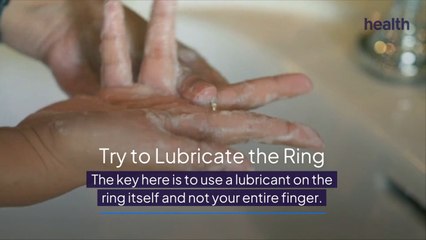 How to Get a Ring Off a Swollen Finger—And When It's an Emergency