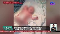 Donasyon para sa conjoined twins, tinangay ng scammer| SONA