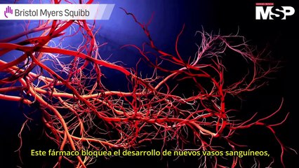 ¿Qué y cuándo? Secuenciación de fármacos en Mieloma Múltiple en recaída y refractario