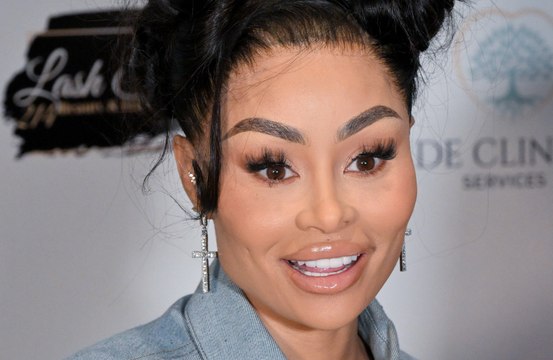 Blac Chyna no ha explicado sus cambios de estilo de vida y reversiones de cirugía estética a sus hijos