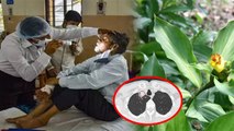 Kolkata Man First Time Plant Fungus Infected, World में पहली बार गंभीर बीमारी का Symptom | BoldskyC