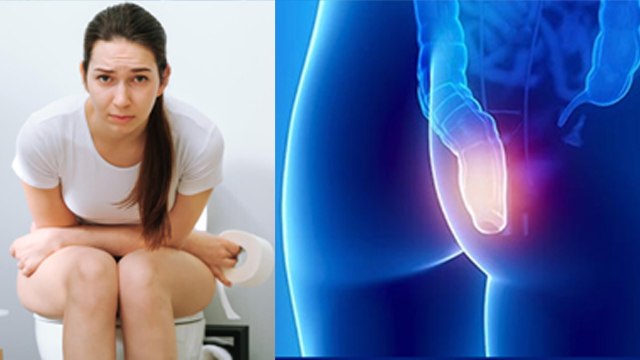 Anal Cancer Symptoms | एनल कैंसर के लक्षण | Anal Cancer Causes | Boldsky