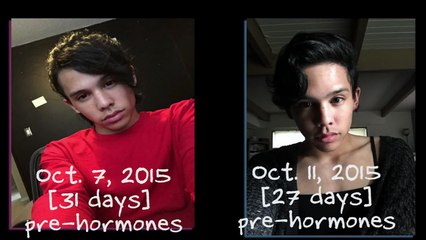 ONE YEAR ON HORMONES! MtF Transition Timeline