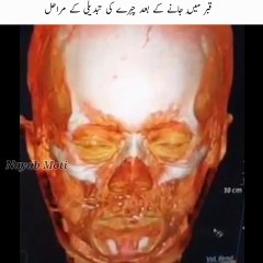merny k bad Insane ka chehra kasy bdalta ha