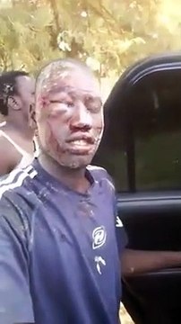 Photos-Video: Affrontements entre pêcheurs de Cayar et Mboro: Plusieurs blessés enregistrés