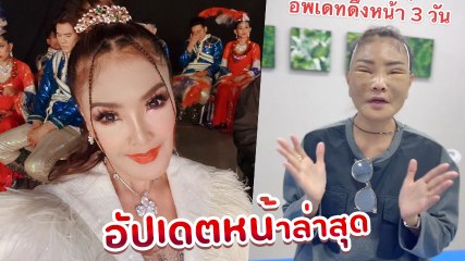 ดาว มยุรี เผยใบหน้า หลังทำศัลยกรรมครบ 3 วัน ชาวเน็ตแห่คอมเมนต์สนั่น