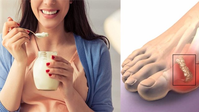 दही खाने से यूरिक एसिड बढ़ता है क्या | Dahi Khane Se Uric Acid Badhta Hai Kya | Boldsky