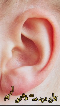 Ear pain treatment. Kan mein dard ka ilaajh .Treatment of earache .کان درد کا علاج