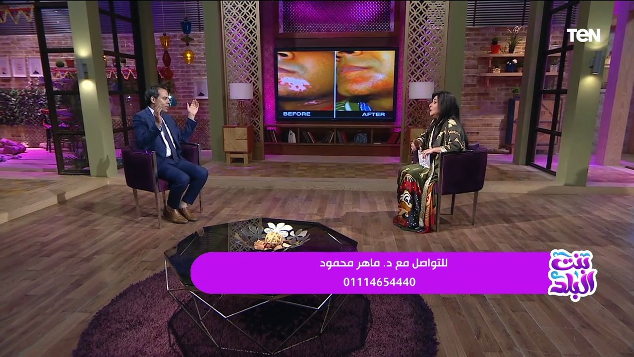 هل البهاق مرض معدي؟.. د. ماهر محمود إستشاري الأمراض الجلدية يجيب