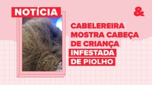 Cabeleireira mostra cabeça de criança infestada de piolho