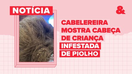 Cabeleireira mostra cabeça de criança infestada de piolho