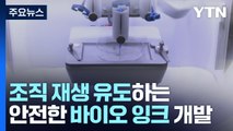 부러진 뼈에 바르면 재생!...치료되면 사라지는 바이오잉크 / YTN