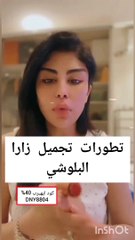 زارا البلوشي تكشف تطورات عملية التجميل الخاصة بها وأماكن الألم