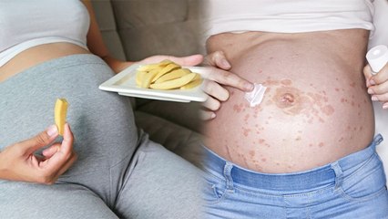 प्रेगनेंसी में आम खाना चाहिए या नहीं | Pregnancy Me Aam Khana Chahiye Ya Nahi | Boldsky
