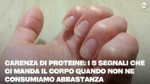 Carenza di proteine i 5 segnali che ci manda il corpo quando non ne consumiamo abbastanza