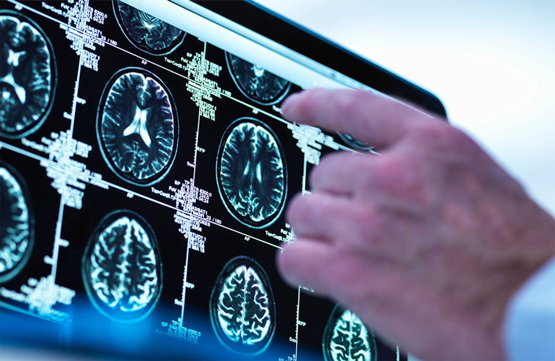 New cancer treatment technology could 'revolutionise treatment of brain tumours'