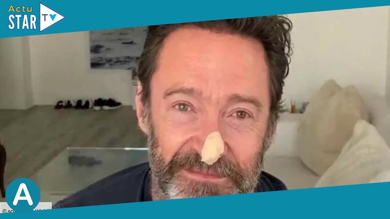 Hugh Jackman apparaît avec un pansement sur le nez, il lance un message important à ses fans