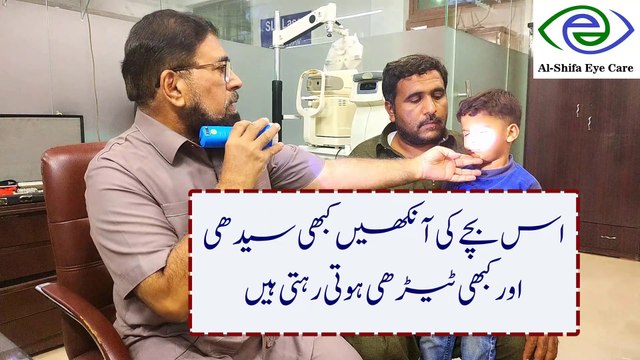 Squint eye (strabismus) treatment without surgery | Vision Therapy | Urdu Hindi