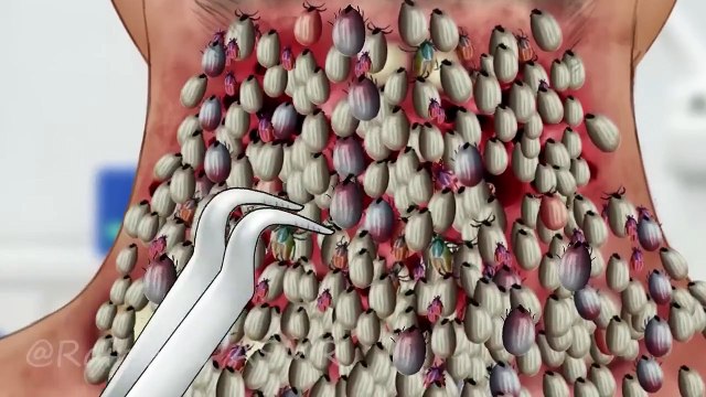 ASMR Removal Maggot Infected & Dog Ticks _ Severely Injured Animation