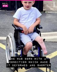 Little Mountaineer: The Inspiring Journey of a 4-Year-Old Amputee