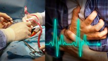 Heart Attack के बाद Blood Donate कर सकते है कि नहीं, Expert Advice | Boldsky