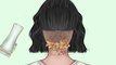 ASMR Giant hardened flakes dandruff removal at hairline | Scalp treatment animation