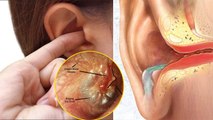 कान में उंगली डालने से क्या होता है | कान में उंगली डालना Ear Fungal Infection | Boldsky