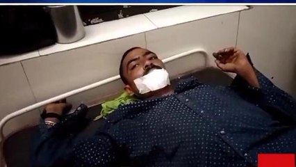 सीधी: पारिवारिक विवाद के चलते एक व्यक्ति के साथ हुई मारपीट अस्पताल में चल रहा इलाज