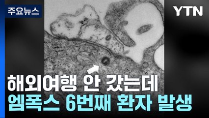 엠폭스 국내 6번째 환자 발생...첫 지역사회 감염 추정 / YTN