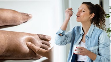 रोजाना दही क्यों नहीं खानी चाहिए, Weight Gain से लेकर Joint Pain तक का खतरा | Boldsky