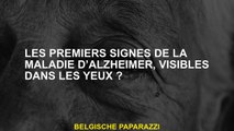 Les premiers signes de la maladie d’Alzheimer, visibles dans les yeux ?