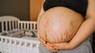Pregnancy Me Stretch Marks Kab Aate Hai | प्रेगनेंसी में स्ट्रेच मार्क्स कब आते है | Boldsky