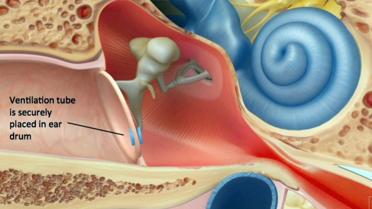 eustachian tube dysfunction@rahmancare