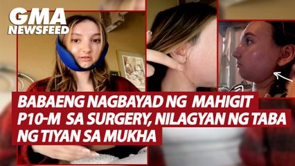 Babaeng nagbayad ng mahigit P10-M sa surgery, nilagyan ng taba ng tiyan sa mukha | GMA News Feed