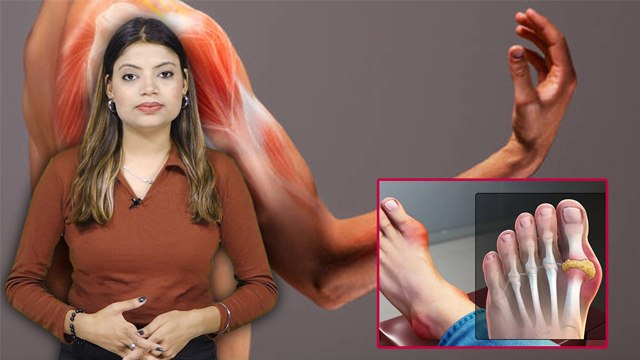 Uric Acid क्या होता है, Body में ये क्यों बढ़ता है, Symptoms और Reason, Treatment | Boldsky