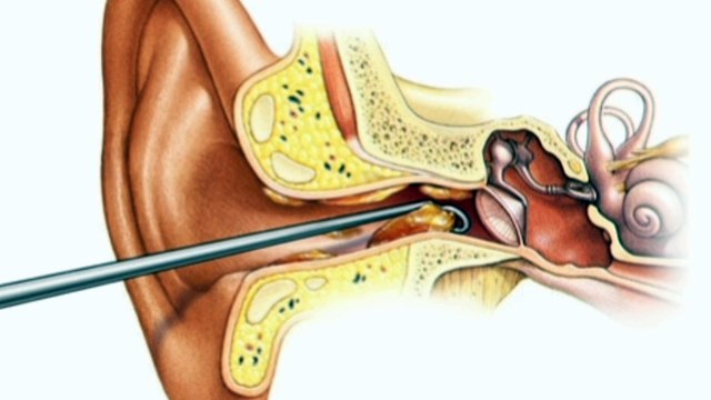 Top 7 causes of clogged ear in urdu
