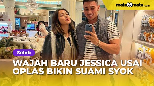 Wajah Baru Jessica Iskandar usai Oplas Bikin Vincent Verhaag Syok: Yang Penting Nafas Sudah Lancar