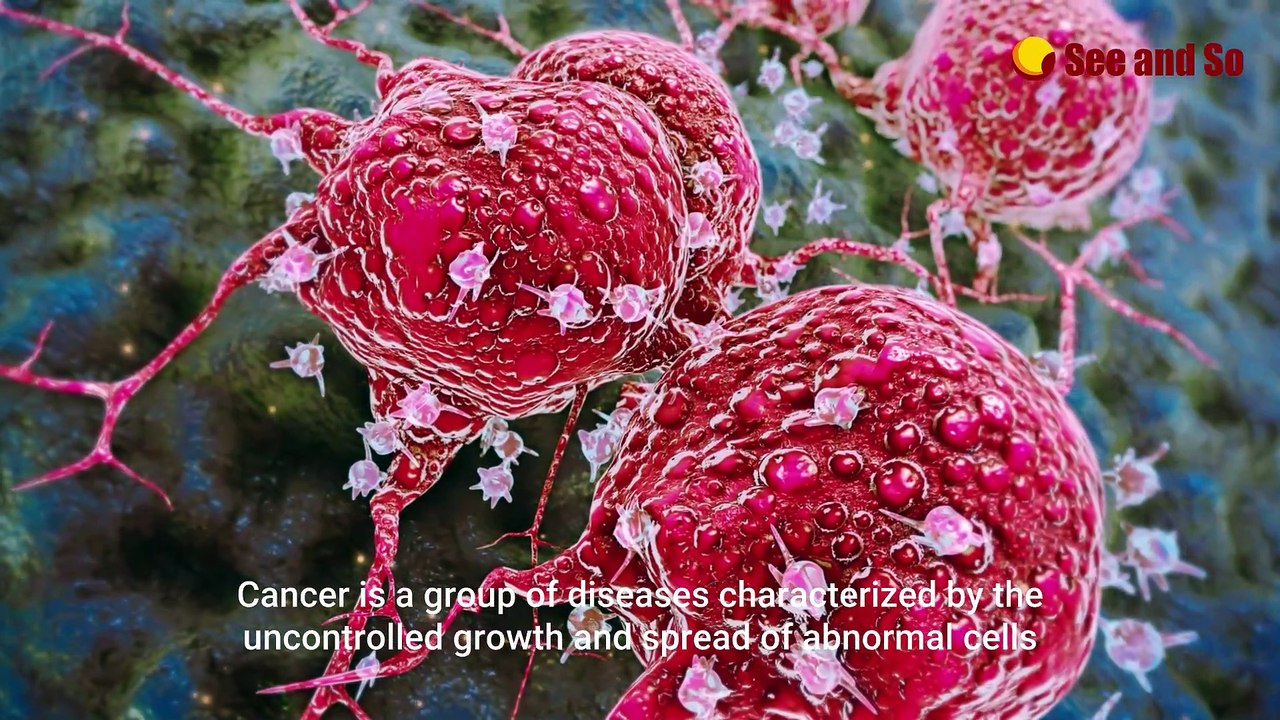 These are the often overlooked signs of skin cancer