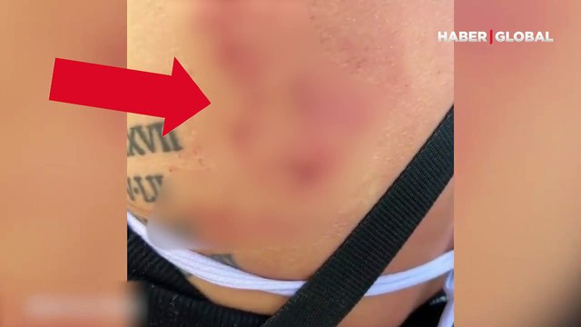 Korku an kamerada! Köpek balığı dalış yapan kadının arkasından yaklaşıp onu böyle ısırdı