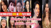 top bollywood actresses plastic surgery 2023 , bollywood surgery fails, Urdu stories with khan
