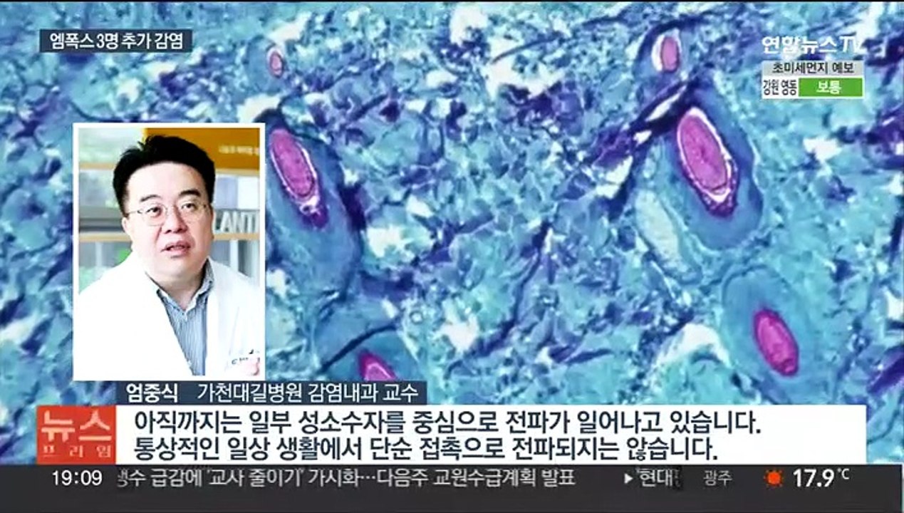 [이슈5] 지역사회 번져버린 엠폭스…국내감염 환자 3명 추가 外