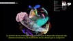 Atlas Celular Humano: ¿Cómo funciona el mapeo de todas las células humanas?