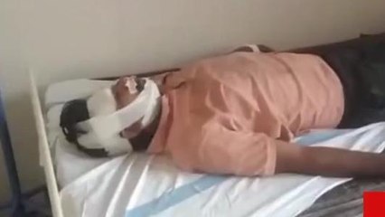 सीधी: बाइक अनियंत्रित होने से चालक हुआ घायल, सर में आई गंभीर चोट