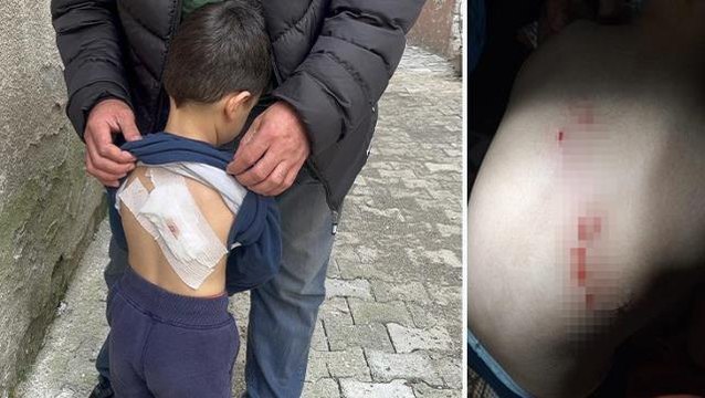 Sokakta oyun oynayan çocuğa başıboş köpekler saldırdı