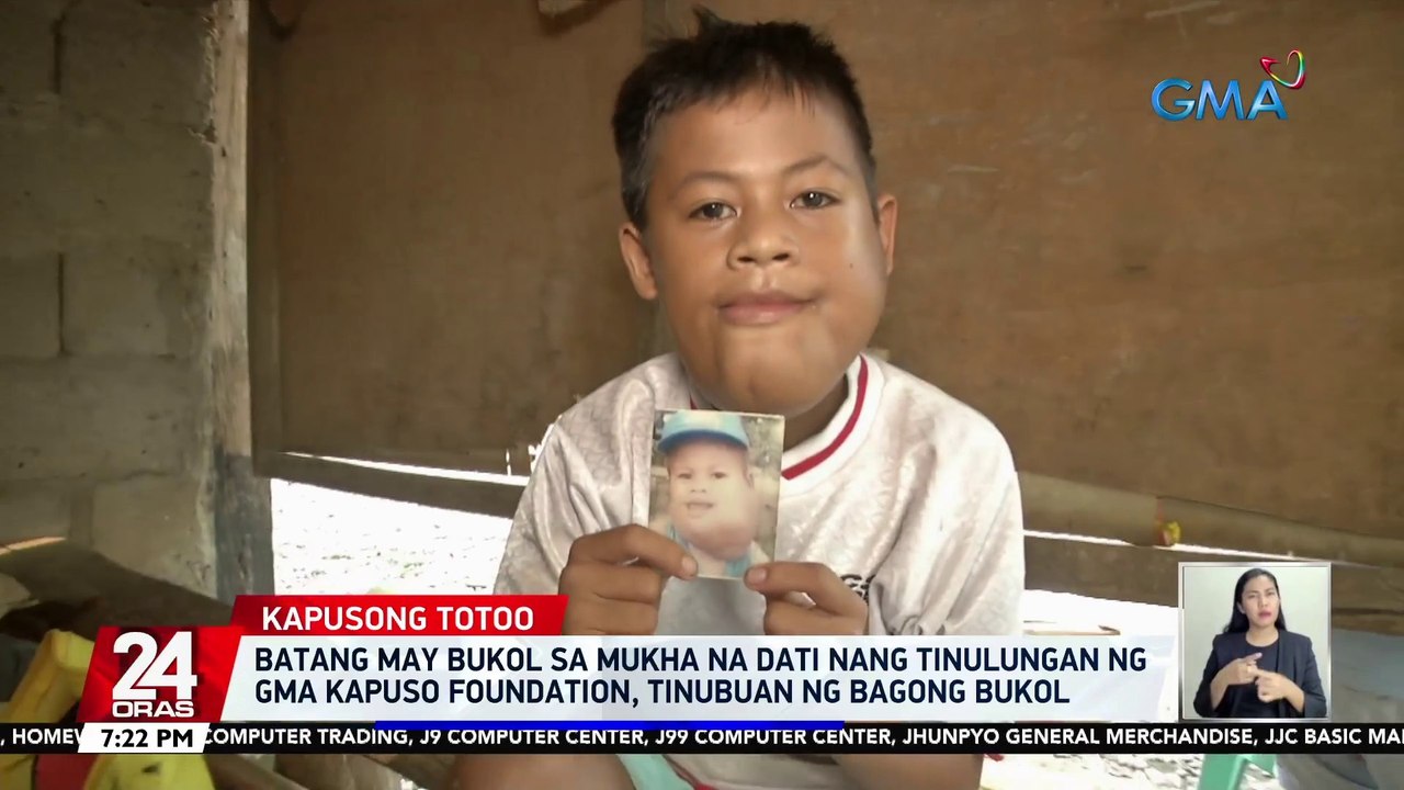 Batang may bukol sa mukha na dati nang tinulungan ng GMA Kapuso Foundation, tinubuan ng bagong bukol | 24 Oras