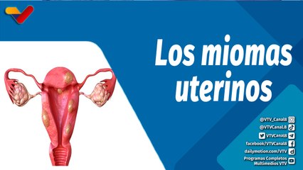 Actitud Saludable | Qué son los miomas uterinos y cómo tratarlos