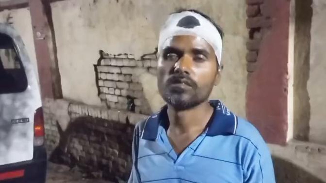 शाहजहांपुर:जमीन बंटवारे को लेकर भाइयों में हुई मारपीट में एक भाई का सर फूटा