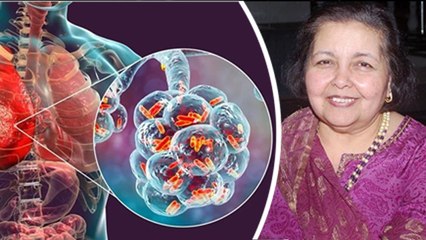 Pamela Chopra का Pneumonia से Demise कैसे हुआ, Reason आया सामने । Boldsky