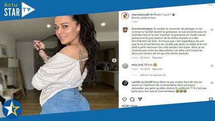 “Le ventre gonflé, des plis dans le dos…” : cet avant/après de Shanna Kress, toujours en quête de so